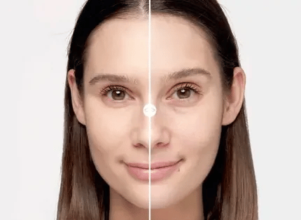 ✨PEELING RENOVACION ✨