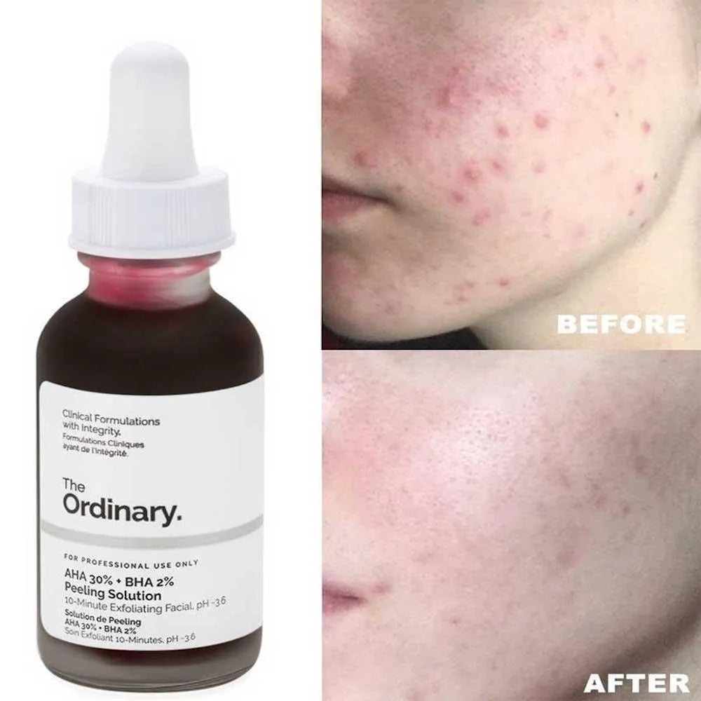 ✨PEELING RENOVACION ✨