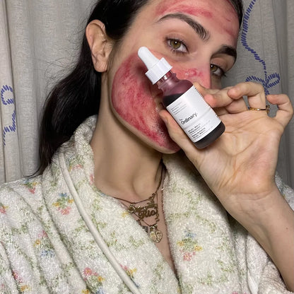 ✨PEELING RENOVACION ✨