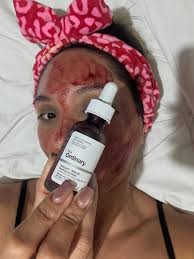 ✨PEELING RENOVACION ✨